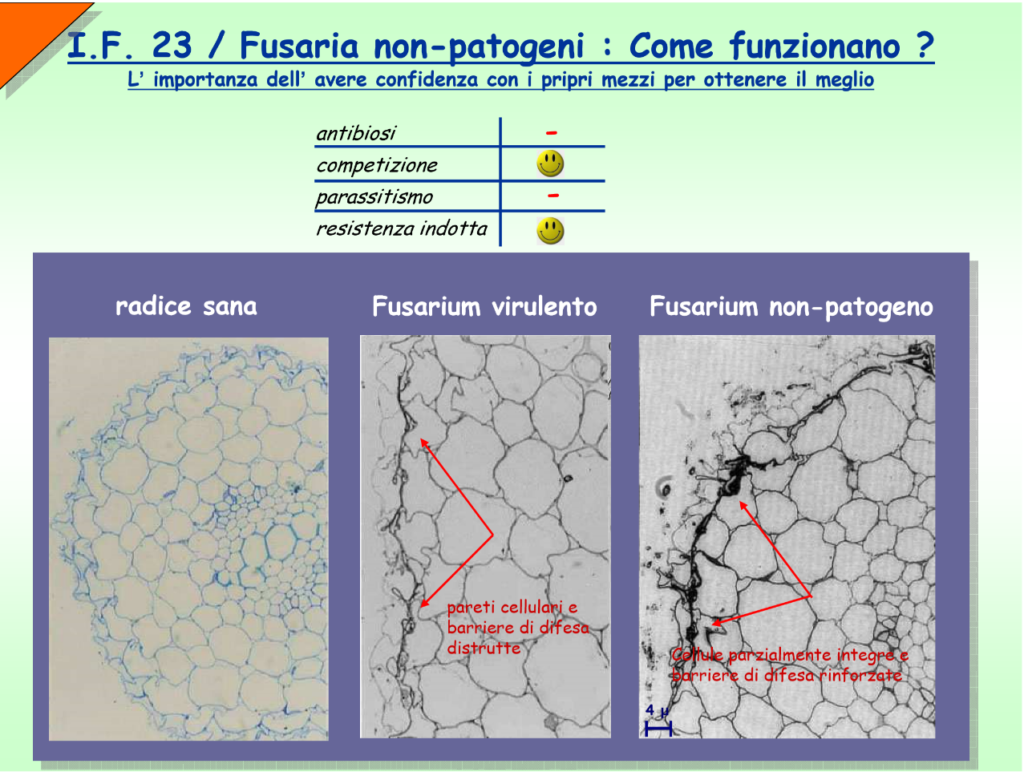 Ispessimento Pareti Del Sigma Cause